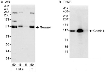 Rabbit Gemin4 Antibody