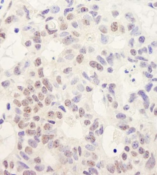 Rabbit DHX38 Antibody