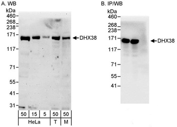 Rabbit DHX38 Antibody