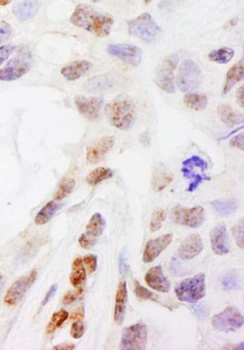 Rabbit DHX38 Antibody
