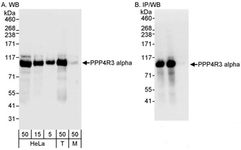 Rabbit PPP4R3 Alpha Antibody