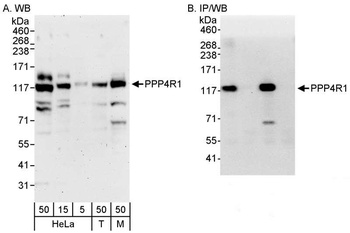 Rabbit PPP4R1 Antibody