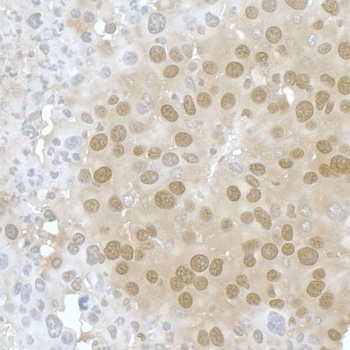 Rabbit PPP4C Antibody