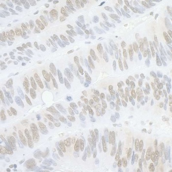 Rabbit PPP4C Antibody