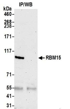 Rabbit RBM15 Antibody