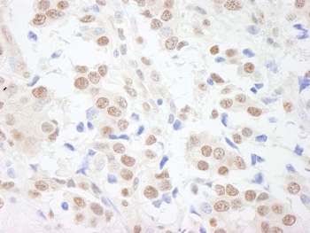 Rabbit SAFB1 Antibody