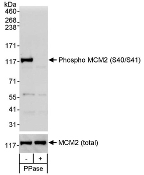 Rabbit Phospho MCM2 (S40/S41) Antibody
