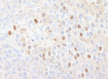 Rabbit CDT1 Antibody