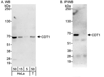 Rabbit CDT1 Antibody