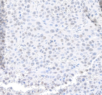 Rabbit MED12 Antibody