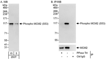 Rabbit Phospho MCM2 (S53) Antibody