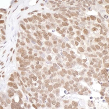Rabbit anti-PRMT1 Antibody