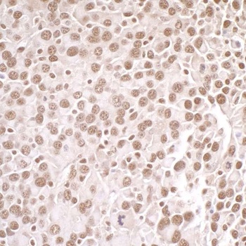 Rabbit PRMT1 Antibody