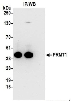 Rabbit PRMT1 Antibody