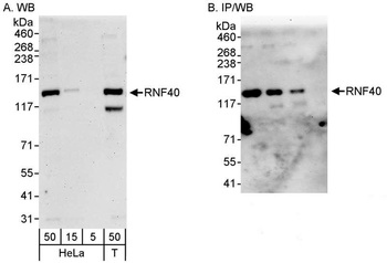 Rabbit anti-RNF40 Antibody