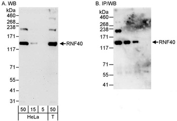 Rabbit anti-RNF40 Antibody