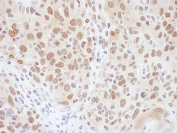 Rabbit RNF20 Antibody