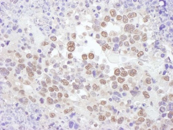 Rabbit RNF20 Antibody