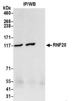 Rabbit RNF20 Antibody