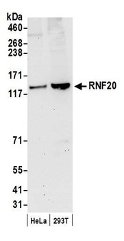 Rabbit RNF20 Antibody