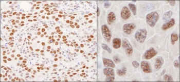 Rabbit hnRNP-U Antibody