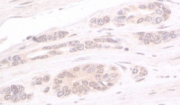 Rabbit ATRIP Antibody