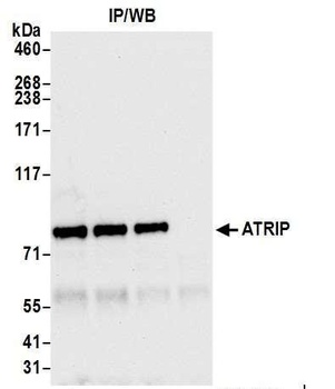 Rabbit ATRIP Antibody