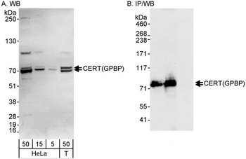 Rabbit CERT/GPBP Antibody
