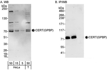 Rabbit CERT/GPBP Antibody