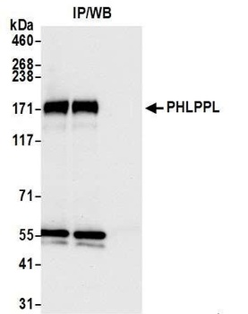 Rabbit PHLPPL Antibody