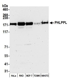 Rabbit PHLPPL Antibody