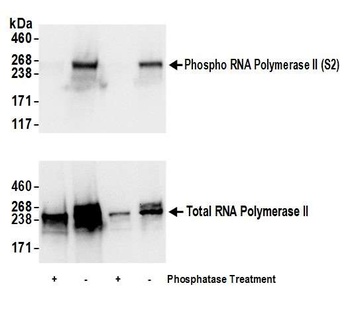 Rabbit Phospho RNA Polymerase II (S2) Antibody