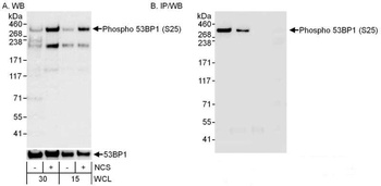 Rabbit Phospho 53BP1 (S25) Antibody