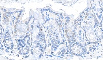 Rabbit GAPDH Antibody