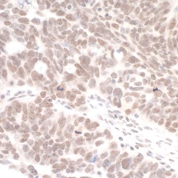 Rabbit DHX8 Antibody