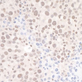 Rabbit DHX8 Antibody