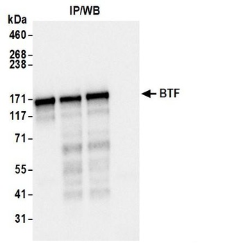 Rabbit anti-BTF Antibody