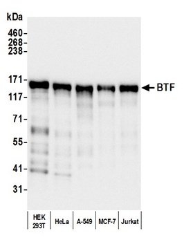 Rabbit anti-BTF Antibody