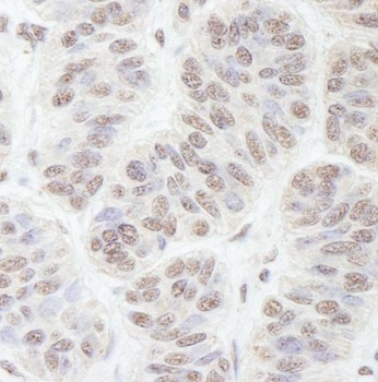 Rabbit GNL3 Antibody