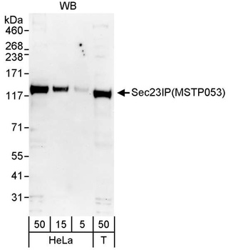 Rabbit Sec23IP/MSTP053 Antibody
