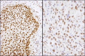 Rabbit Matrin 3 Antibody
