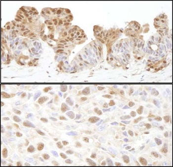 Rabbit anti-VCP Antibody