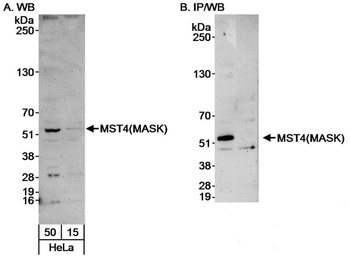 Rabbit MST4/MASK Antibody