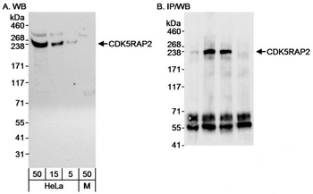 Rabbit CDK5RAP2 Antibody
