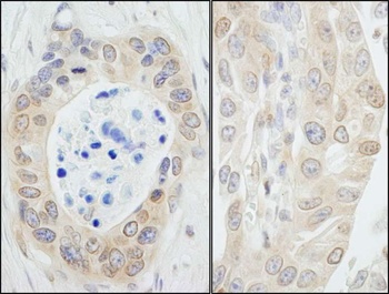 Rabbit NMI Antibody