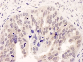 Rabbit NMI Antibody
