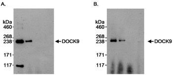 Rabbit DOCK9 Antibody