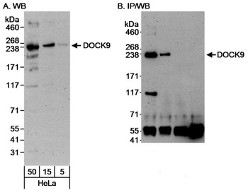 Rabbit DOCK9 Antibody