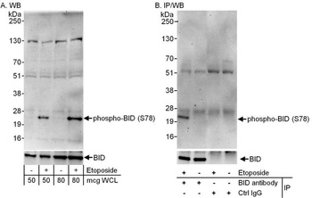 Rabbit Phospho BID (S78) Antibody