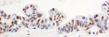 Rabbit hnRNP-H Antibody